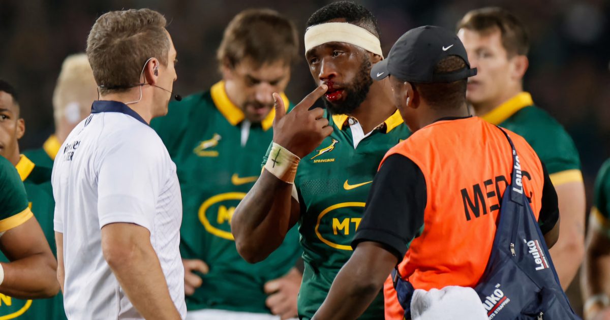 Springboks suffer double injury shock in victory over All Blacks