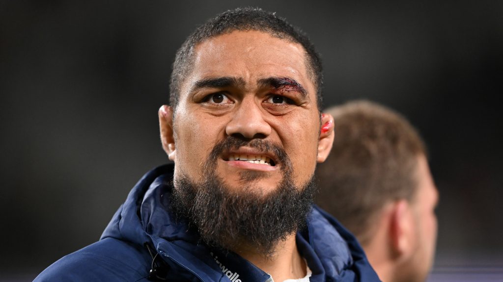 All Blacks' latest injury replacement withdrawn from Lions game with illness